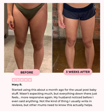 Pelvera Fit™ Thigh & Pelvic Trainer